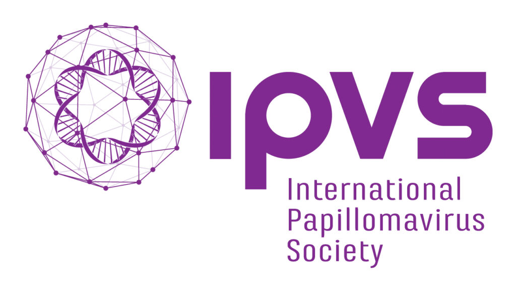 IPVS